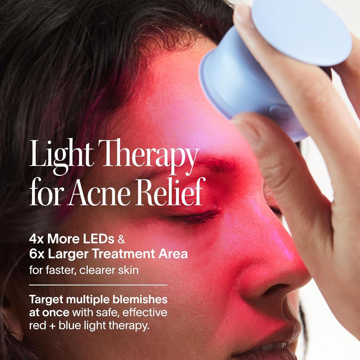 Bye Acne: Advanced Blue & Red Light Therapy Device for Face and Body, Effectively Reduces Redness, Pimples, Zits, and Blemishes While Calming Inflammation - Quick 3-Minute Treatment, User-Friendly Design