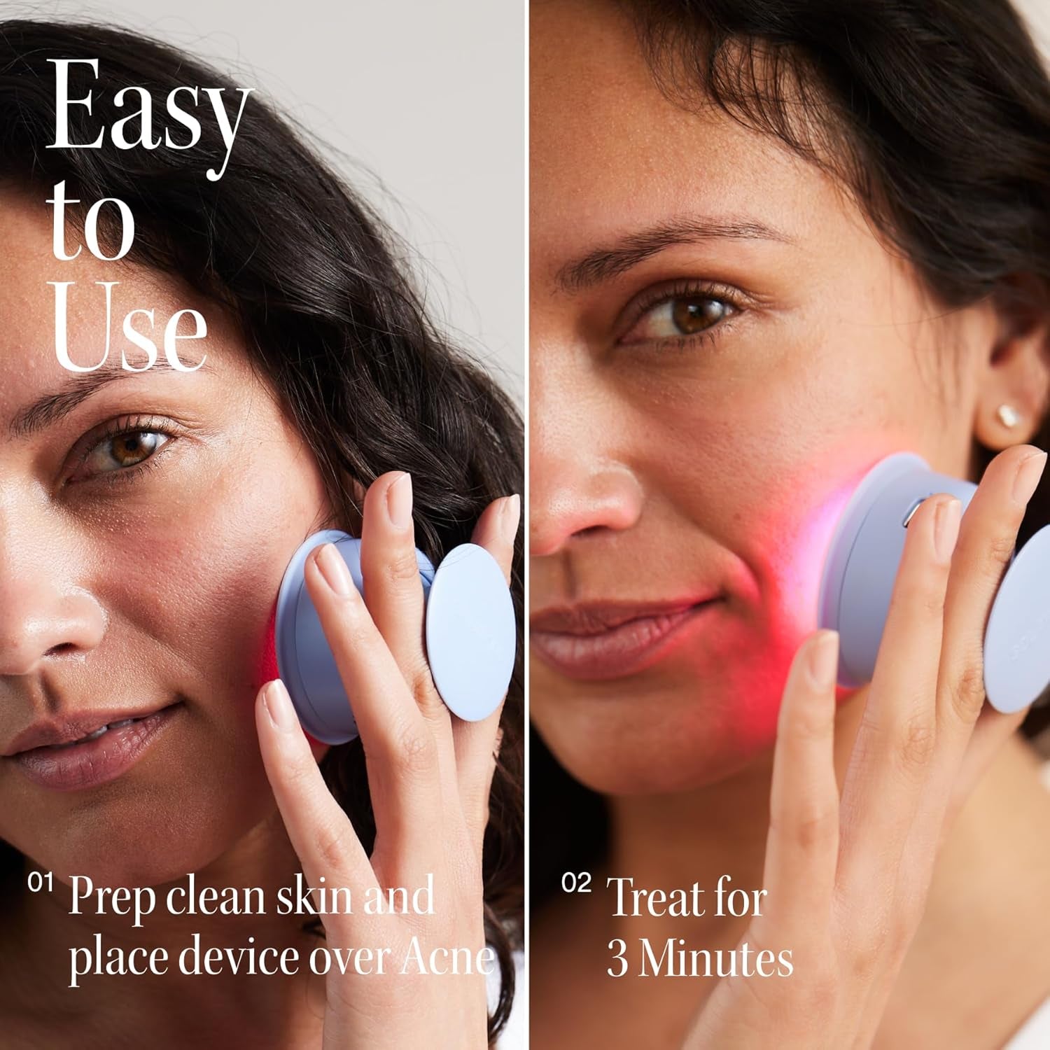Bye Acne: Advanced Blue & Red Light Therapy Device for Face and Body, Effectively Reduces Redness, Pimples, Zits, and Blemishes While Calming Inflammation - Quick 3-Minute Treatment, User-Friendly Design
