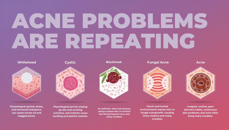 Pimple Patches — acne type guide infographic for whitehead and surface blemishes